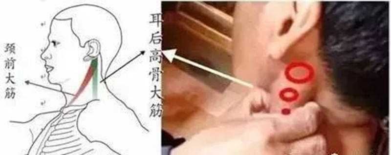 记住“三条筋”，能治很多病！
